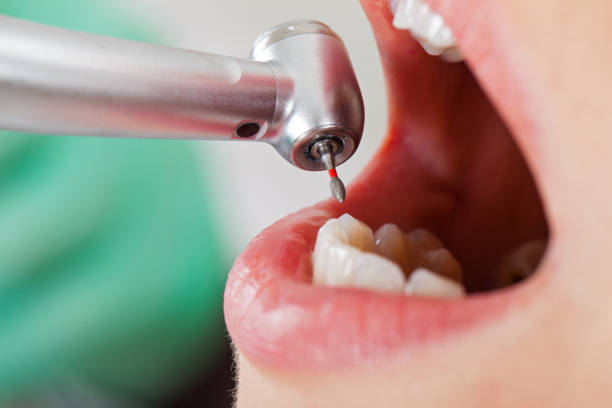 Best Emergency Treatment for Oral Infections in Summit, AZ